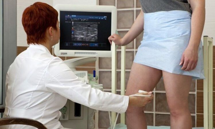 Lazerinis krešėjimas varikozės venų gydymui