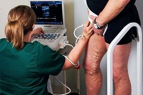 Kojų varikozės venų diagnostikos galimybės