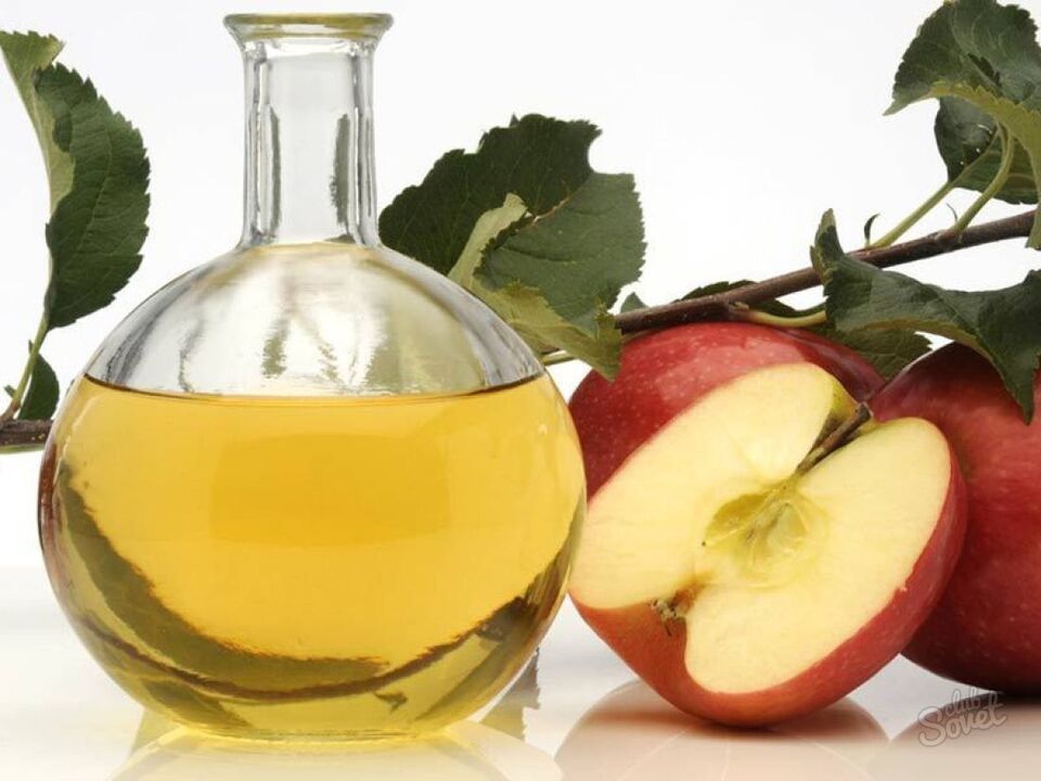 obuolių sidro actas nuo varikozinių venų